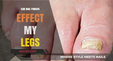 Can Nail Fungus Spread to My Legs? Facts and Prevention Tips