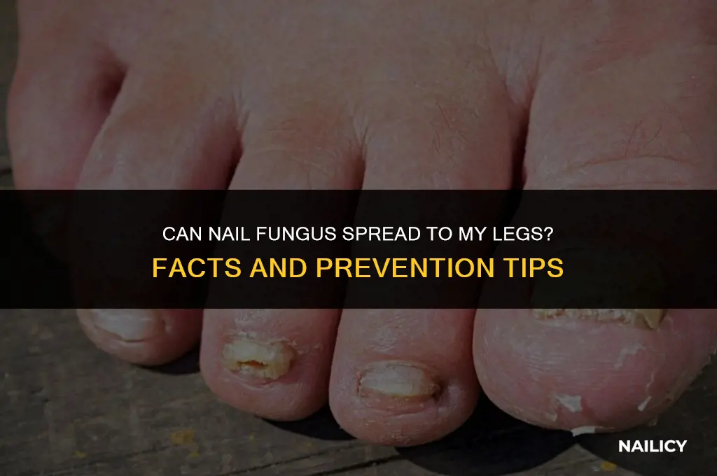 can nail fungus effect my legs