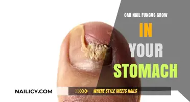 Exploring the Myths: Can Nail Fungus Really Grow in Your Stomach?
