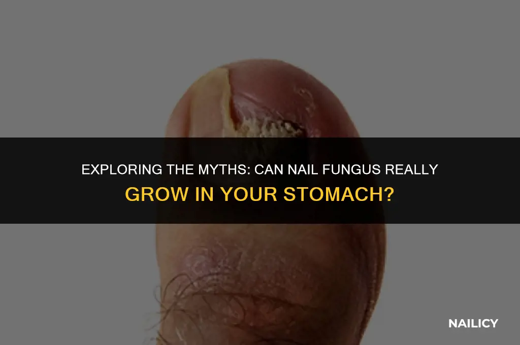 can nail fungus grow in your stomach