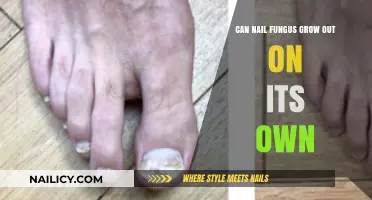 Can Nail Fungus Resolve Naturally? Understanding the Healing Process
