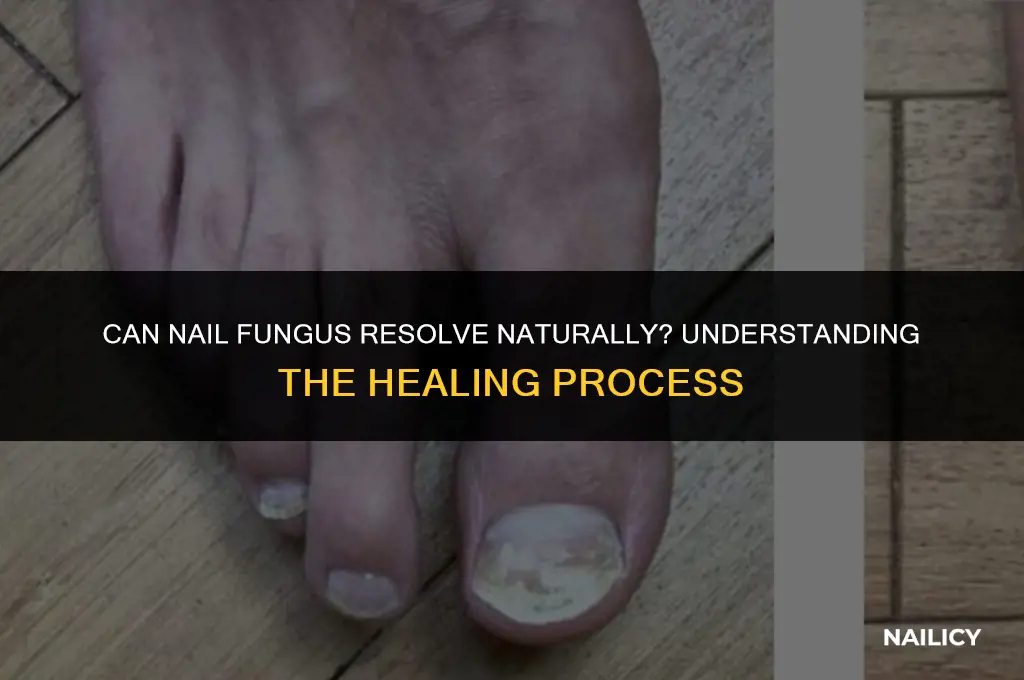 can nail fungus grow out on its own
