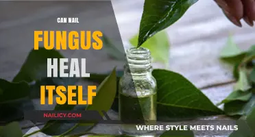 Can Nail Fungus Heal Itself? Understanding the Condition and Its Remedies