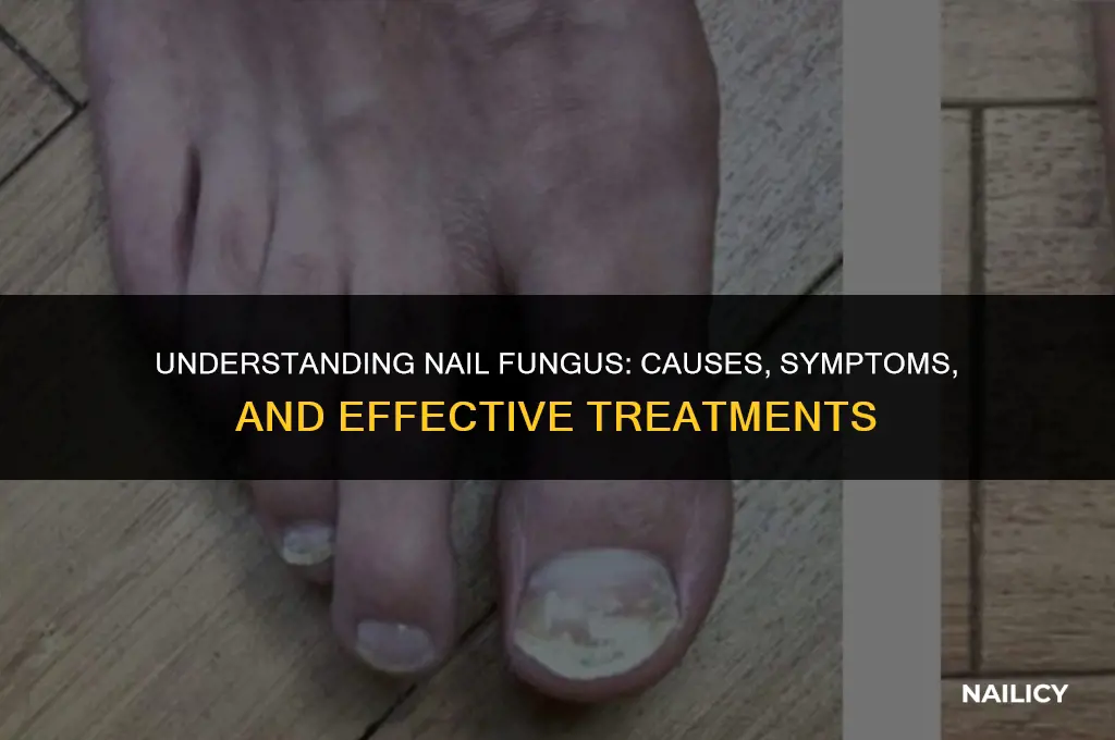 can nail fungus hurt