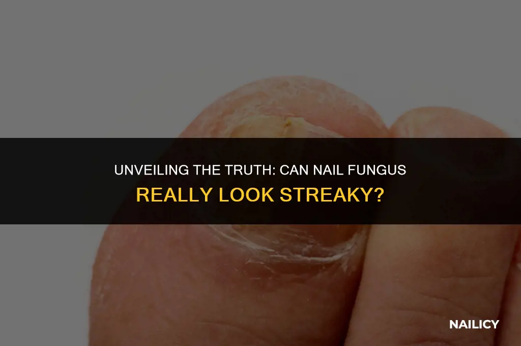 can nail fungus look streaky