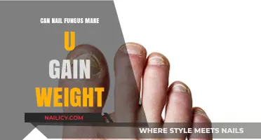 Exploring the Surprising Link Between Nail Fungus and Weight Gain