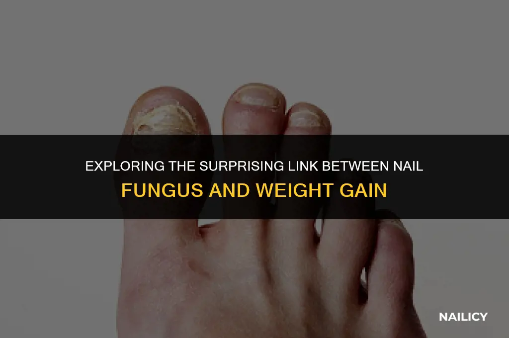 can nail fungus make u gain weight