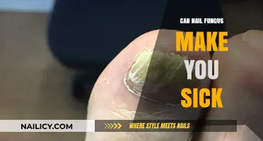 The Hidden Dangers of Nail Fungus: Can It Make You Sick?