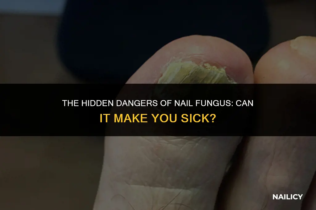 can nail fungus make you sick