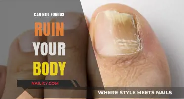 The Hidden Dangers of Nail Fungus: Protect Your Body Now