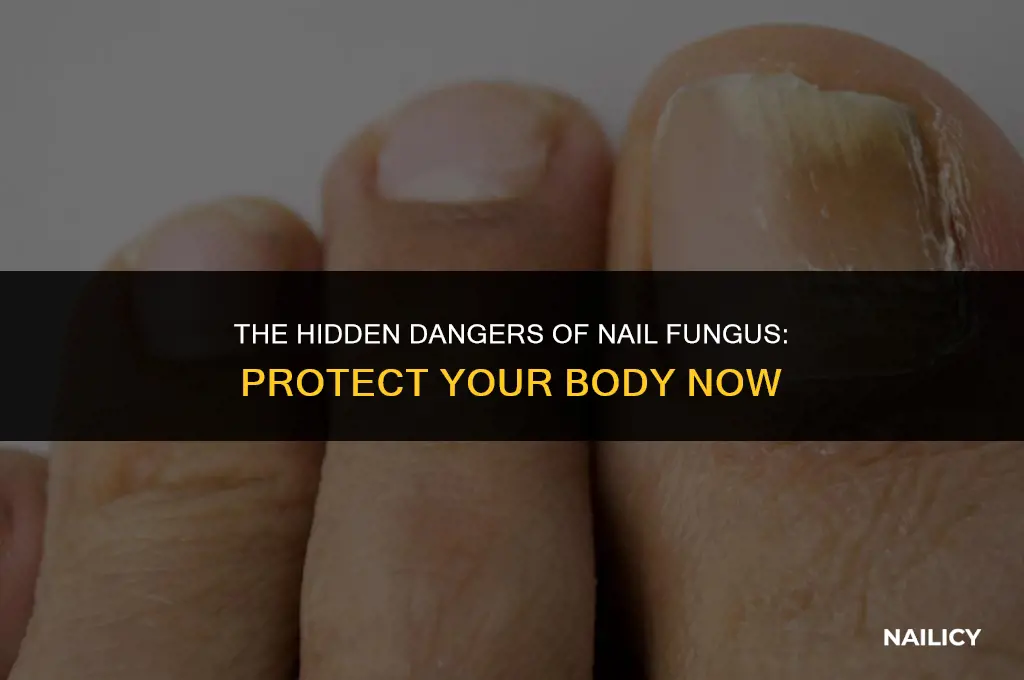 can nail fungus ruin your body