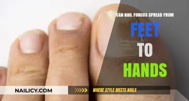 From Feet to Hands: The Truth About Nail Fungus Transmission
