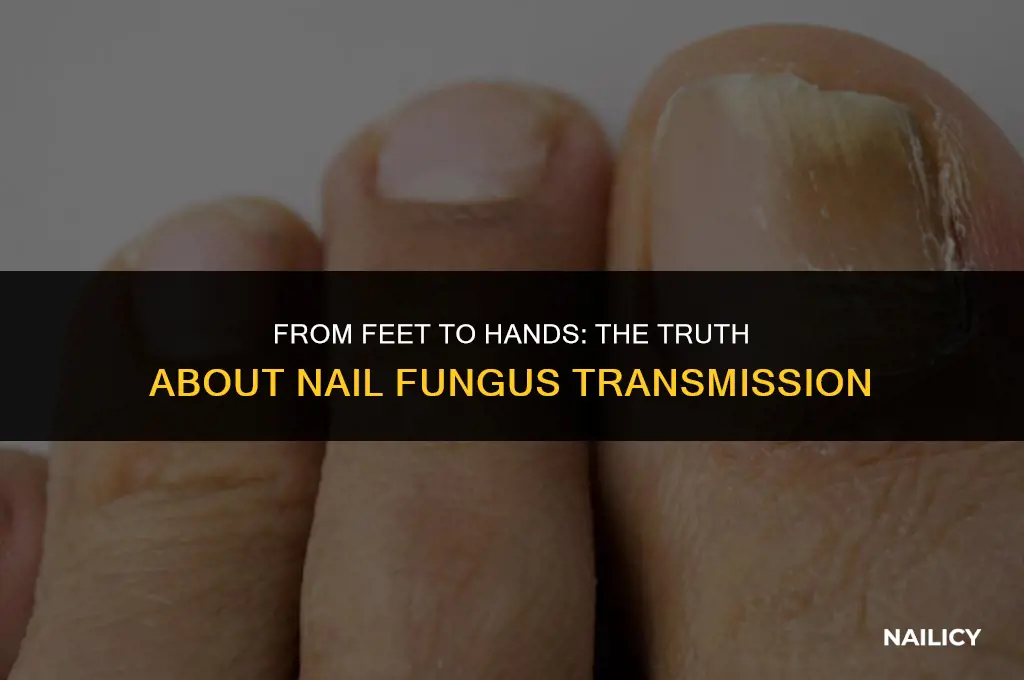 can nail fungus spread from feet to hands
