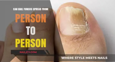 Understanding Nail Fungus Transmission: Can It Spread Between People?