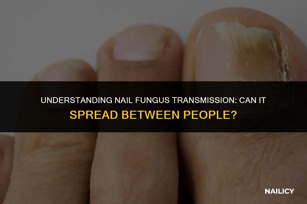 can nail fungus spread from person to person