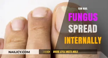 Exploring the Risks: Can Nail Fungus Spread Internally?