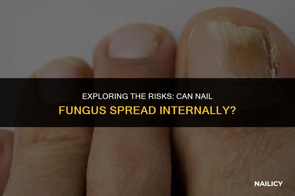 can nail fungus spread internally