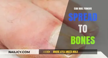 Debunking Myths: Can Nail Fungus Really Spread to Your Bones?