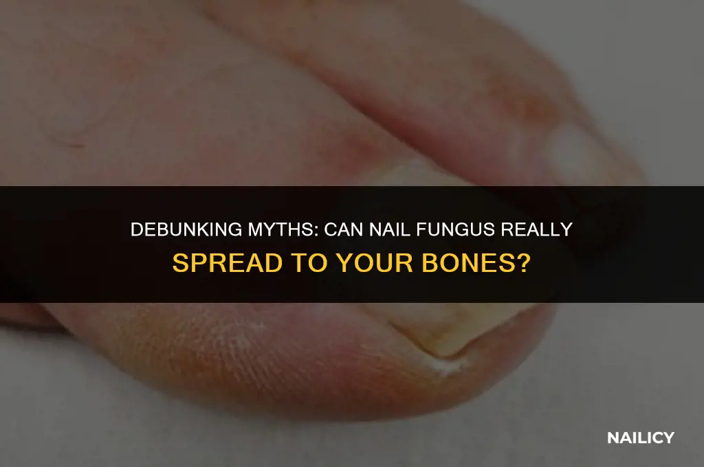 can nail fungus spread to bones