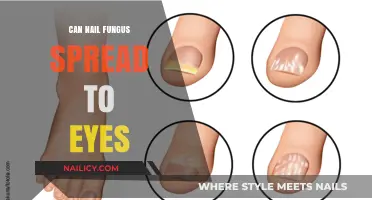 Can Nail Fungus Spread to Eyes: Facts and Prevention Tips