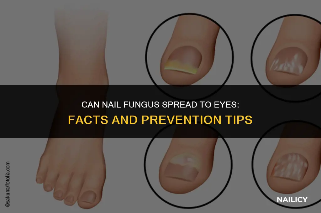 can nail fungus spread to eyes