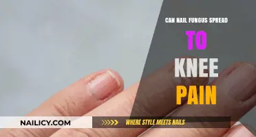 Exploring the Link: Can Nail Fungus Cause Knee Pain?