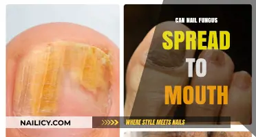 Oral Health Alert: Can Nail Fungus Really Spread to Your Mouth?