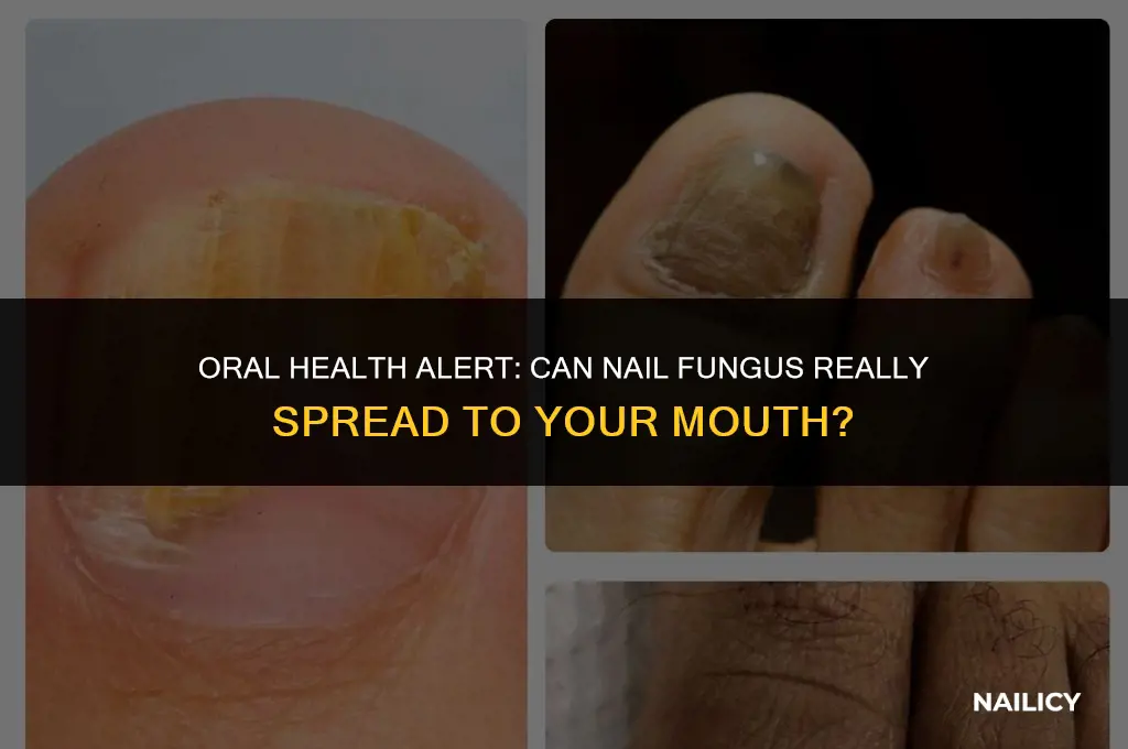 can nail fungus spread to mouth