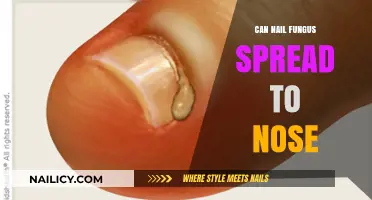 Can Nail Fungus Spread to Your Nose? Facts and Prevention Tips