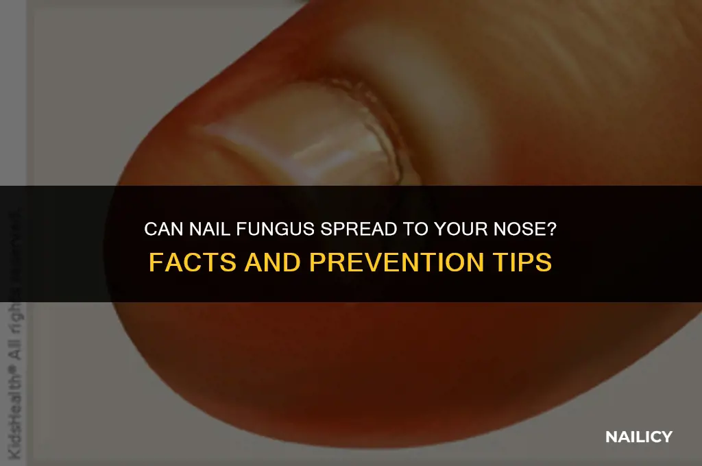 can nail fungus spread to nose