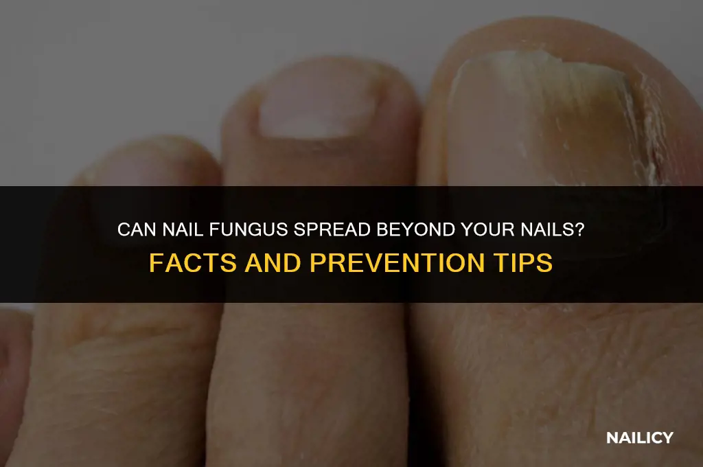 can nail fungus spread to other parts of bady