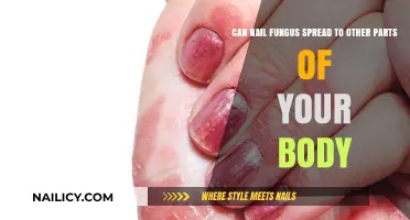 Can Nail Fungus Spread Beyond Your Nails? Facts and Prevention Tips