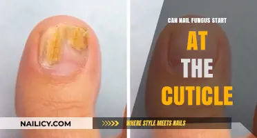 Unveiling the Truth: Can Nail Fungus Originate at the Cuticle?