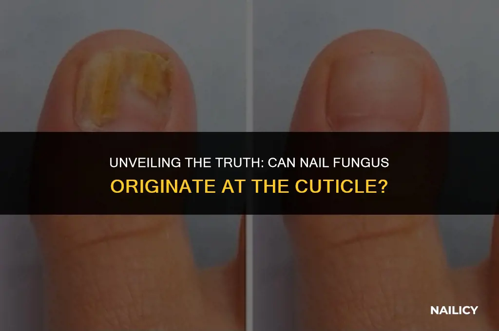 can nail fungus start at the cuticle