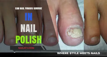 Can Nail Fungus Survive in Nail Polish? Unveiling the Truth