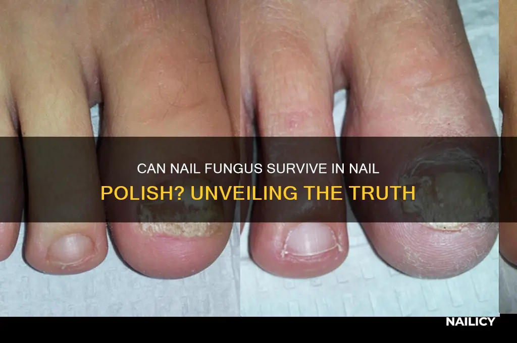 can nail fungus survive in nail polish