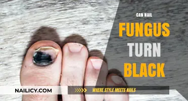 Understanding Nail Fungus: Can It Really Turn Black?