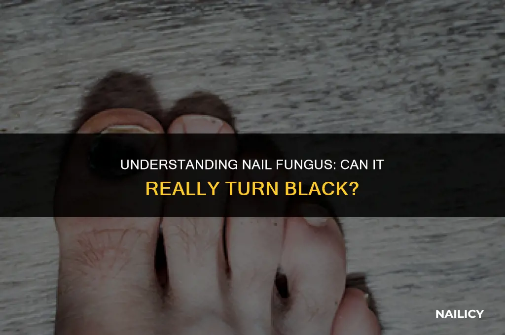 can nail fungus turn black