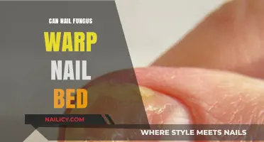 Unveiling the Truth: Can Nail Fungus Really Warp Your Nail Bed?