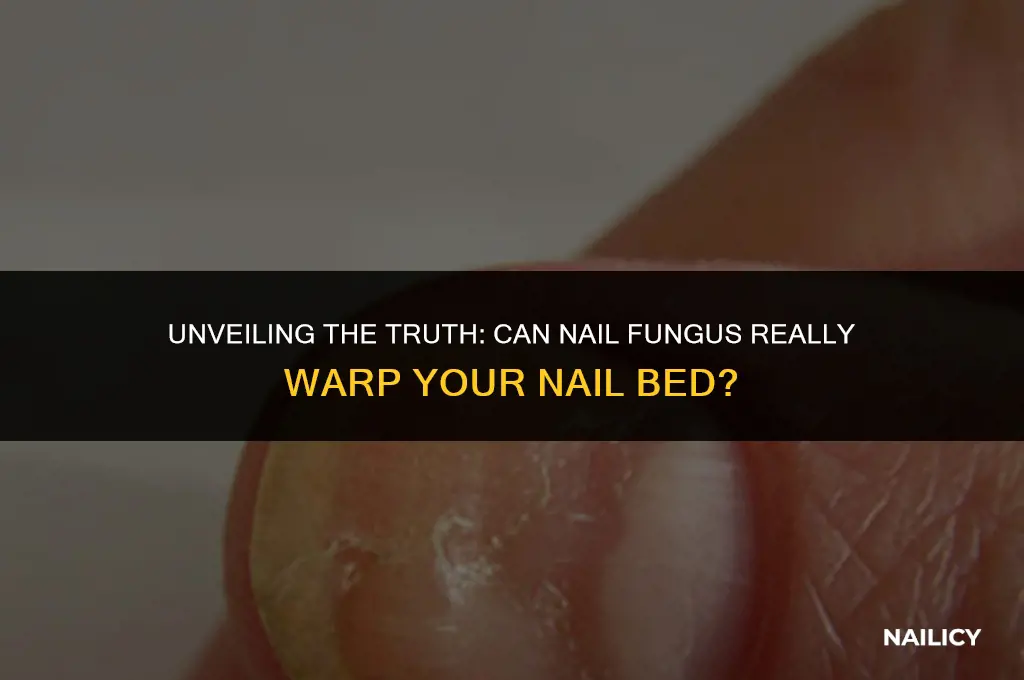can nail fungus warp nail bed