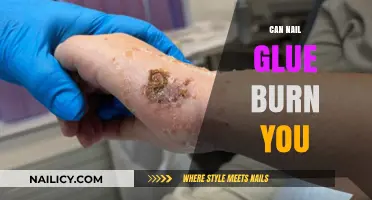 The Surprising Truth About Nail Glue Burns: What You Need to Know
