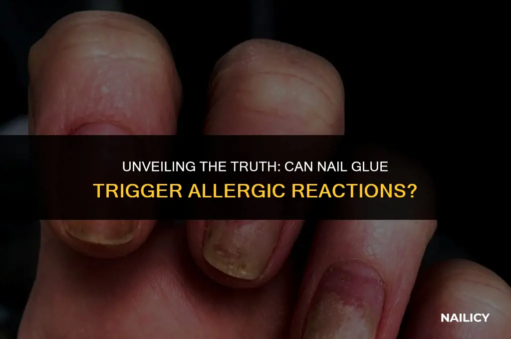 can nail glue cause allergic reaction