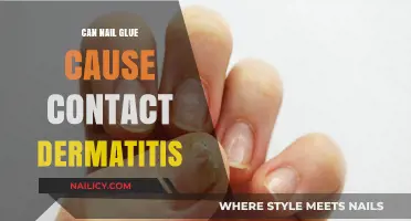 Exploring the Link: Can Nail Glue Trigger Contact Dermatitis?