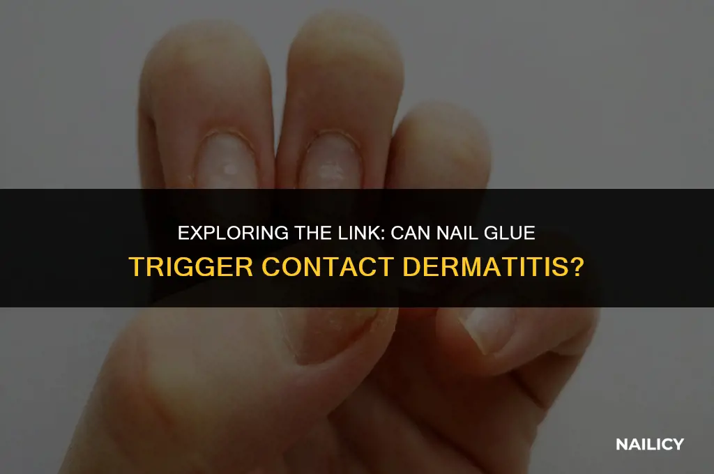 can nail glue cause contact dermatitis