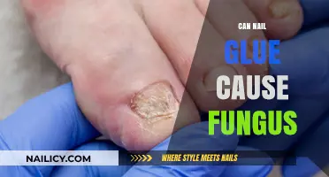 The Surprising Truth About Nail Glue and Fungal Infections