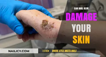 The Surprising Truth About Nail Glue and Skin Damage