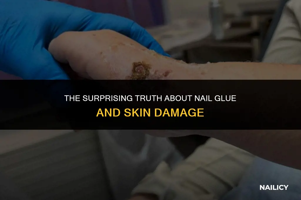 can nail glue damage your skin