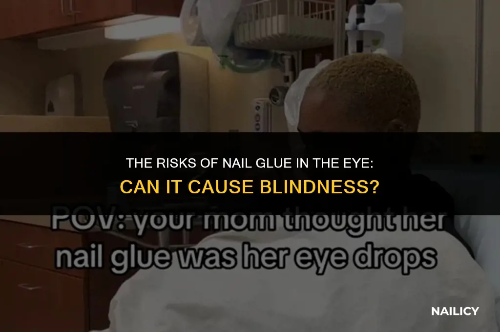 can nail glue in eye cause blindness