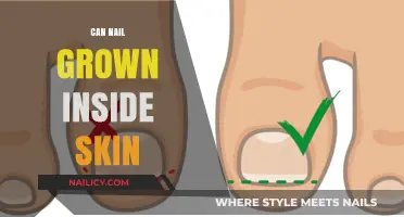 Exploring the Myths and Facts: Can Nails Really Grow Inside Skin?