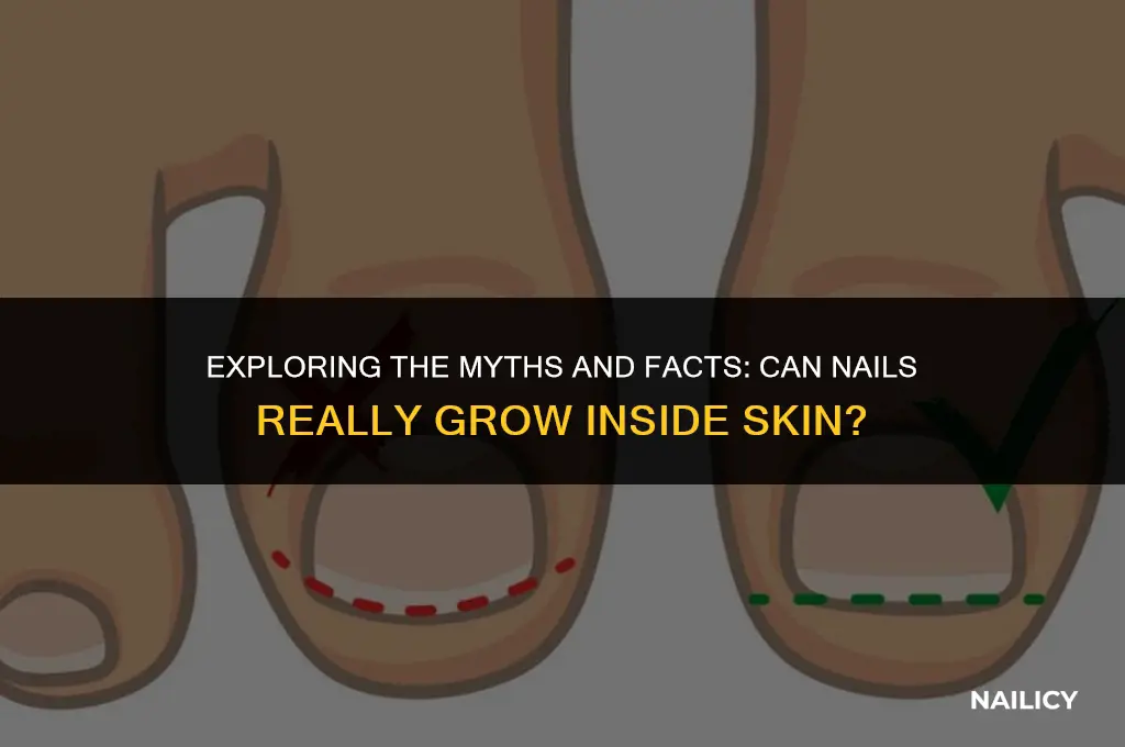 can nail grown inside skin